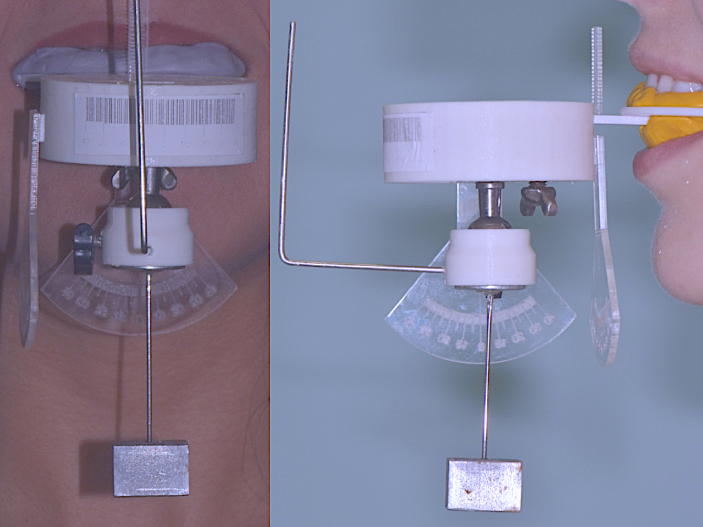 foto-prototipo
