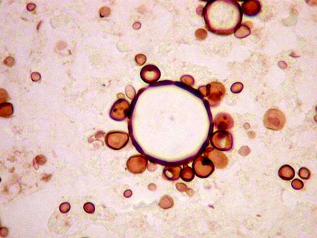 morfologia-pb-forma-infectante